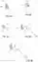 Fig. 09 - Methods of treating nasal airways