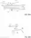 Fig. 40 - Methods of treating nasal airways