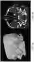 Fig. 06 - Intervention Guidance Device