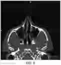 Fig. 07 - Intervention Guidance Device