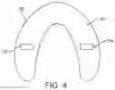 Fig. 04 - Methods for fabricating dental appliances or shells