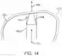 Fig. 10 - Methods for fabricating dental appliances or shells