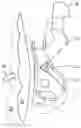 Fig. 01 - Orthodontic appliance and method for moving teeth