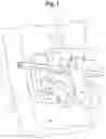 Fig. 02 - Orthodontic appliance and method for moving teeth