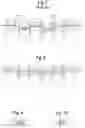 Fig. 05 - Orthodontic appliance and method for moving teeth