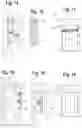 Fig. 08 - Orthodontic appliance and method for moving teeth