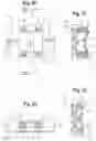 Fig. 09 - Orthodontic appliance and method for moving teeth