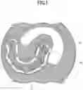 Fig. 02 - RESIN PLATE AND DENTURES PLATE SYSTEM