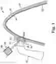 Fig. 02 - Devices, systems, and computer-implemented methods for dental attachment templates