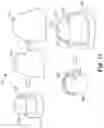 Fig. 08 - Devices, systems, and computer-implemented methods for dental attachment templates