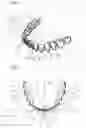 Fig. 02 - Artificial teeth set including mandibular coupled artificial teeth having an arch shape and maxillary coupled artificial teeth having an arch shape