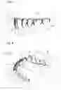 Fig. 03 - Artificial teeth set including mandibular coupled artificial teeth having an arch shape and maxillary coupled artificial teeth having an arch shape