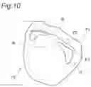 Fig. 09 - Artificial teeth set including mandibular coupled artificial teeth having an arch shape and maxillary coupled artificial teeth having an arch shape