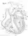 Fig. 02 - Method for replacing a heart valve