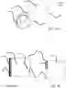 Fig. 09 - Device and associated percutaneous minimally invasive method for creating a venous valve