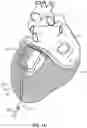 Fig. 02 - Cardiac treatment system