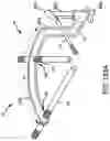Fig. 149 - Spinopelvic fixation technology