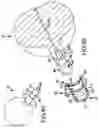 Fig. 45 - Spinopelvic fixation technology