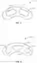 Fig. 03 - Interbody bone implant device