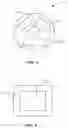 Fig. 04 - Interbody bone implant device