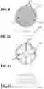 Fig. 06 - Bone infusion apparatus and methods for in interbody grafts