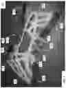 Fig. 02 - SUPPORTS INCLUDING DUAL PIVOT AXES FOR HINGE JOINT