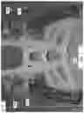 Fig. 08 - SUPPORTS INCLUDING DUAL PIVOT AXES FOR HINGE JOINT
