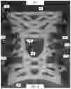 Fig. 09 - SUPPORTS INCLUDING DUAL PIVOT AXES FOR HINGE JOINT