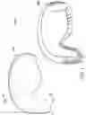 Fig. 02 - Snow goggle device and composite lens