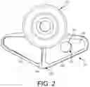 Fig. 03 - Cleaning device system to clean a surgical scope, which cleaning device system includes an attachment element to attach the cleaning device, being positioned outside the body of a patient, to a trocar