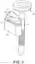 Fig. 04 - Cleaning device system to clean a surgical scope, which cleaning device system includes an attachment element to attach the cleaning device, being positioned outside the body of a patient, to a trocar