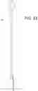 Fig. 22 - Cleaning device system to clean a surgical scope, which cleaning device system includes an attachment element to attach the cleaning device, being positioned outside the body of a patient, to a trocar