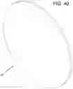 Fig. 40 - Cleaning device system to clean a surgical scope, which cleaning device system includes an attachment element to attach the cleaning device, being positioned outside the body of a patient, to a trocar