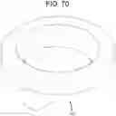 Fig. 70 - Cleaning device system to clean a surgical scope, which cleaning device system includes an attachment element to attach the cleaning device, being positioned outside the body of a patient, to a trocar