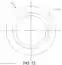 Fig. 72 - Cleaning device system to clean a surgical scope, which cleaning device system includes an attachment element to attach the cleaning device, being positioned outside the body of a patient, to a trocar