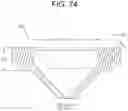 Fig. 74 - Cleaning device system to clean a surgical scope, which cleaning device system includes an attachment element to attach the cleaning device, being positioned outside the body of a patient, to a trocar
