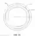 Fig. 75 - Cleaning device system to clean a surgical scope, which cleaning device system includes an attachment element to attach the cleaning device, being positioned outside the body of a patient, to a trocar