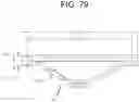 Fig. 79 - Cleaning device system to clean a surgical scope, which cleaning device system includes an attachment element to attach the cleaning device, being positioned outside the body of a patient, to a trocar