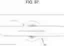 Fig. 97 - Cleaning device system to clean a surgical scope, which cleaning device system includes an attachment element to attach the cleaning device, being positioned outside the body of a patient, to a trocar