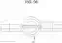 Fig. 98 - Cleaning device system to clean a surgical scope, which cleaning device system includes an attachment element to attach the cleaning device, being positioned outside the body of a patient, to a trocar