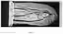 Fig. 06 - Unit-Dose Oral Care Compositions