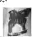Fig. 08 - Tattoo removal
