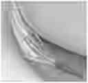 Fig. 01 - METHODS OF TREATING UPPER TRACT UROTHELIAL CARCINOMAS