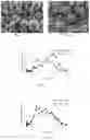 Fig. 02 - Risperidone sustained release microsphere composition