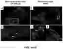 Fig. 16 - HIGHLY SELECTIVE ADENOSINE A3 RECEPTOR SUBTYPE AGONISTS FOR THE PREVENTION AND TREATMENT OF NEURODEGENERATIVE DISORDERS