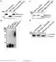 Fig. 08 - Acinetobacter o-oligosaccharyltransferases and uses thereof