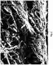 Fig. 09 - A SYNTHETIC IMPLANTABLE SCAFFOLD