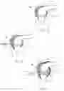 Fig. 02 - Method of using sealants in a gas arthroscopy procedure