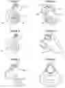 Fig. 02 - Mask for administration of inhaled medication