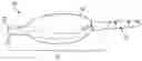 Fig. 01 - METHOD AND APPARATUS FOR PROVIDING ARTIFICIAL VENTILATION TO A TRACHEA OF A PATIENT
